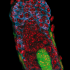 hair follicle featured image