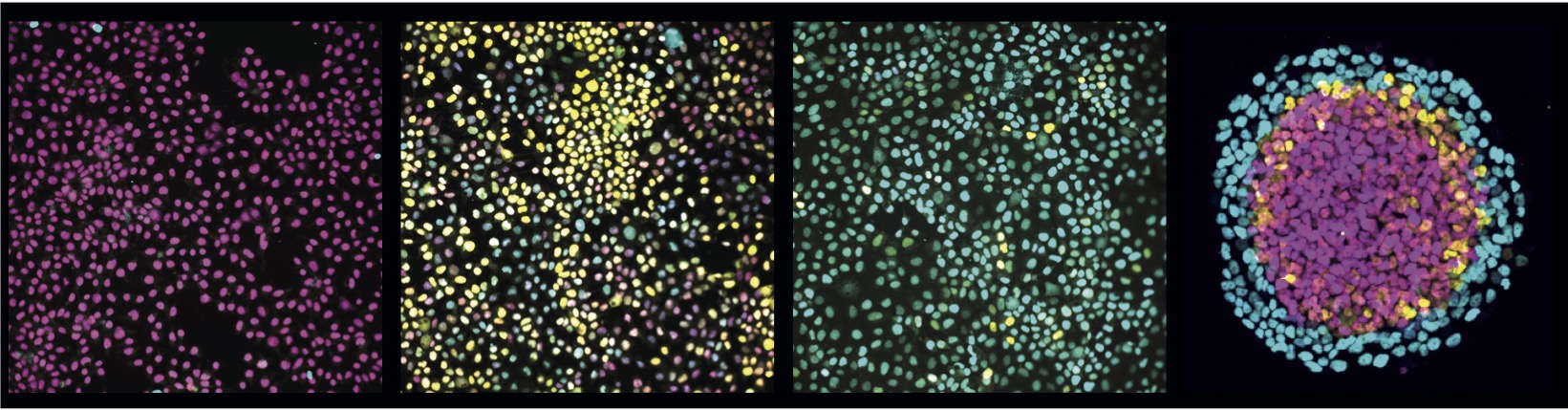 Immunostainings of in vitro cultured human pluripotent stem cells under different experimental conditions.