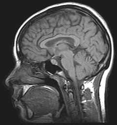MRI brain, NASA