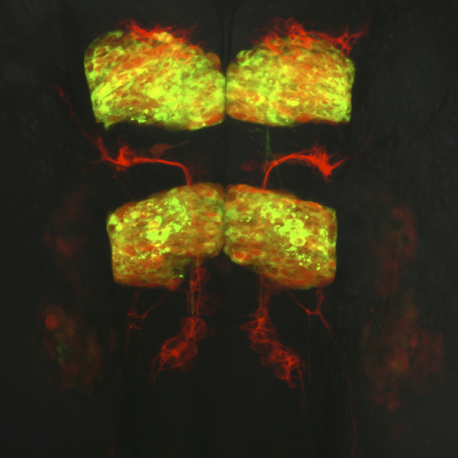 Transgenic zebrafish hindbrain