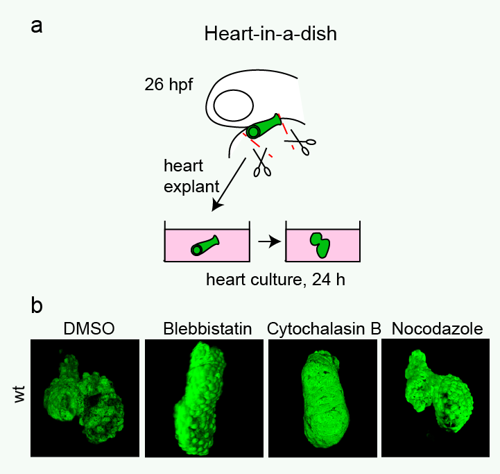 Mechanisms for asymmetric heart morphogenesis: About Nodal and tissue  intrinsic forces - the Node
