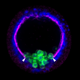 Figure_1_Laminin_Final