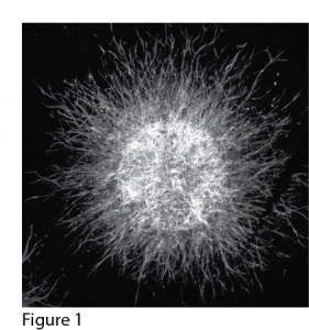 figure 6 EB