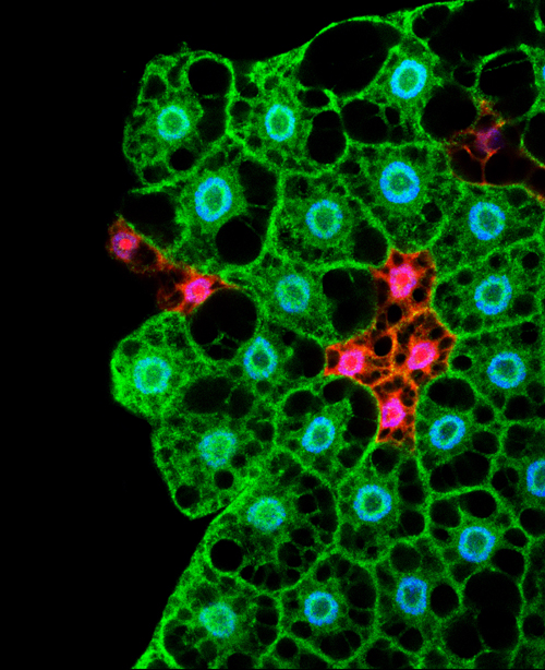 Microscopy image showing cells of the fat body. In Drosophila the storage and management of energy is regulated by cells from this tissue (Lara Barrio, IRB Barcelona)