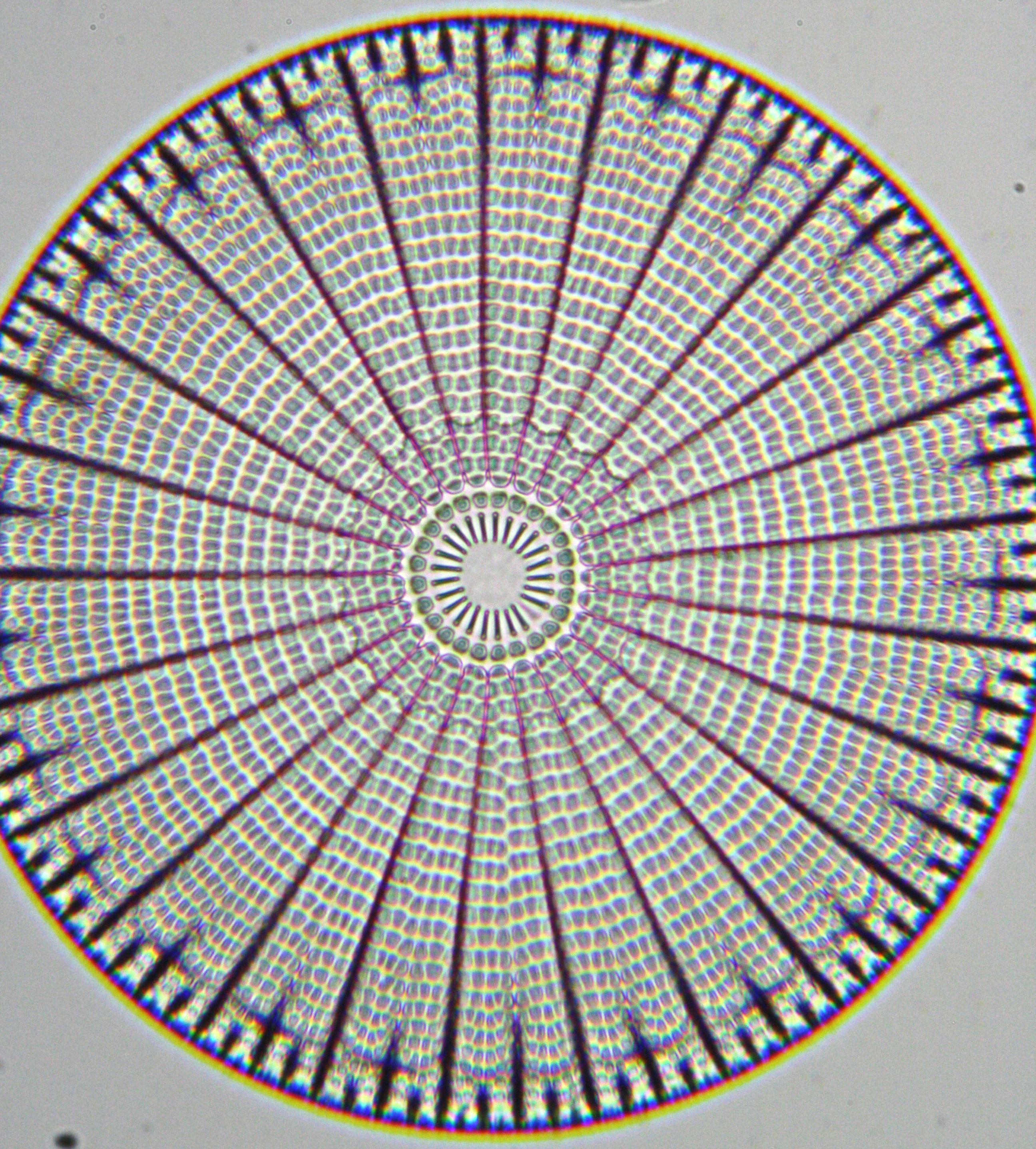 diatom