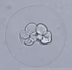 Pleurobrachia embryo