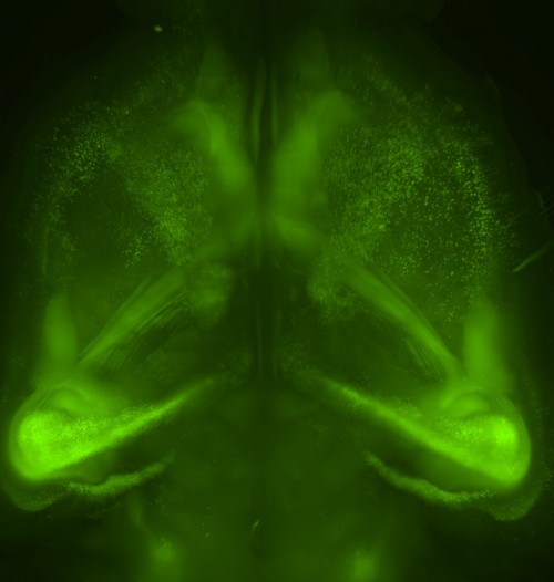 CUBIC-treated mouse brain