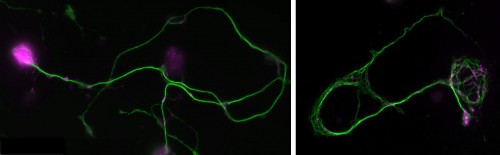 Normal and mutant primary Drosophila neurons in culture.