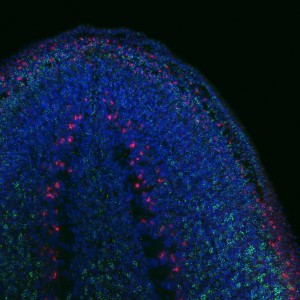 FISH and immunohistochemical staining showing the expression of a domapinergic neuron marker in (red), Tudor (green) and nuclei (blue). Courtesy of Anish Dattani.