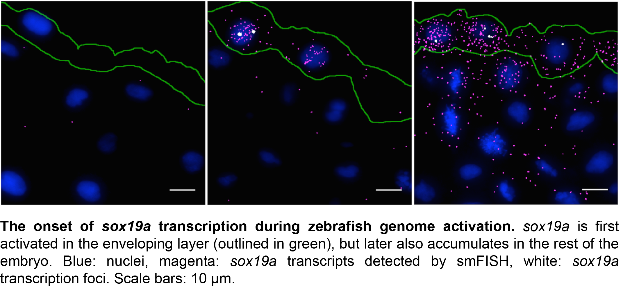 Turbo FISH: A Method for Rapid Single Molecule RNA FISH