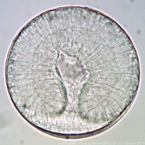 A chaetognath embryo