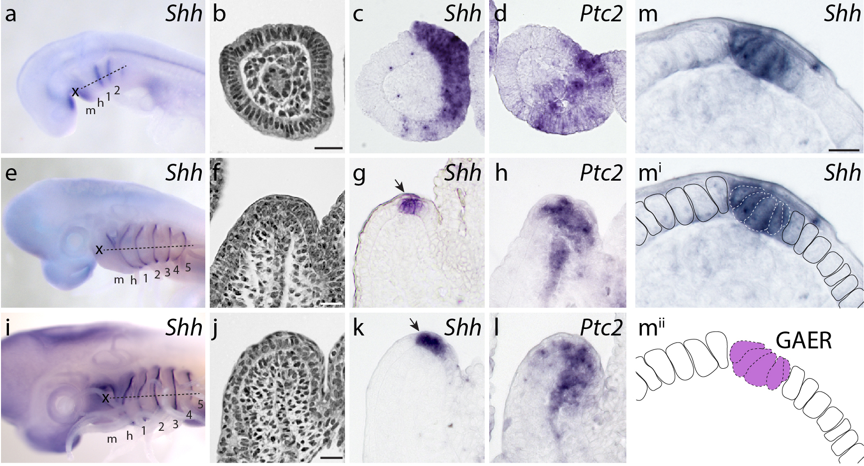 Gills, fins and the evolution of vertebrate paired appendages - the Node