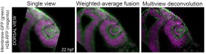 A comparison of image quality among single view data and data processed by two different strategies of multiview fusion
