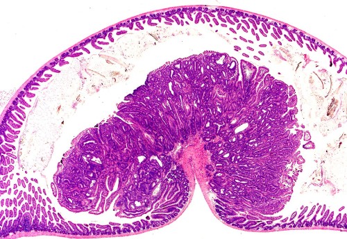 Polypoid adenoma in the small intestine of an apc mutant mouse