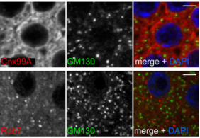 membrane antibodyies