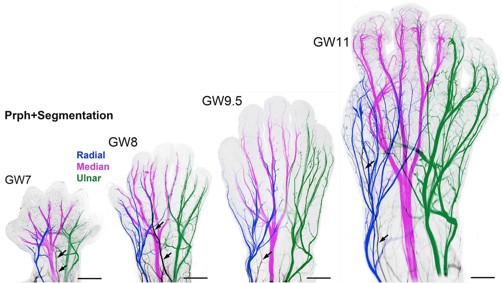Normal Hand Development A New Way To Look At Human Development - the Node