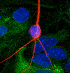 neural stem cell differentiation