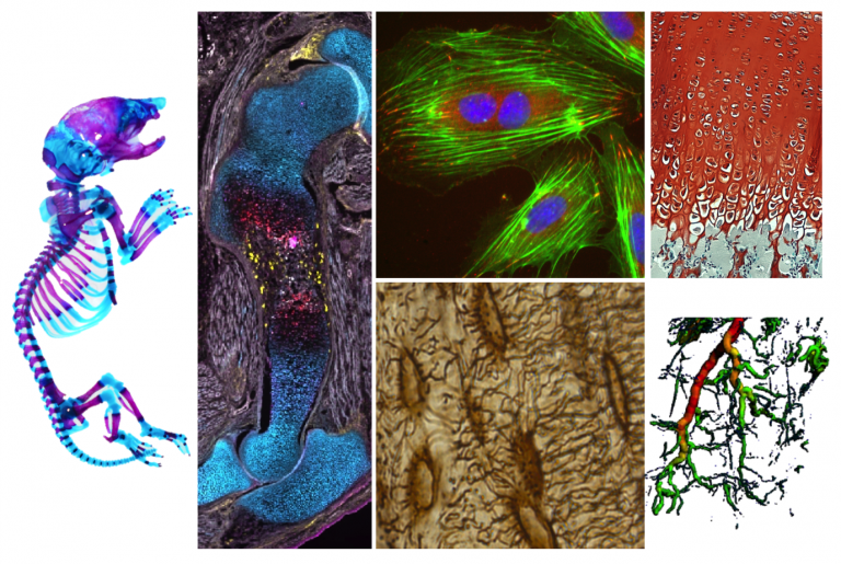 Postdoc: Mechanobiology Of Bone Development And Regeneration - The Node