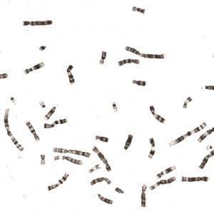 Human chromosomes