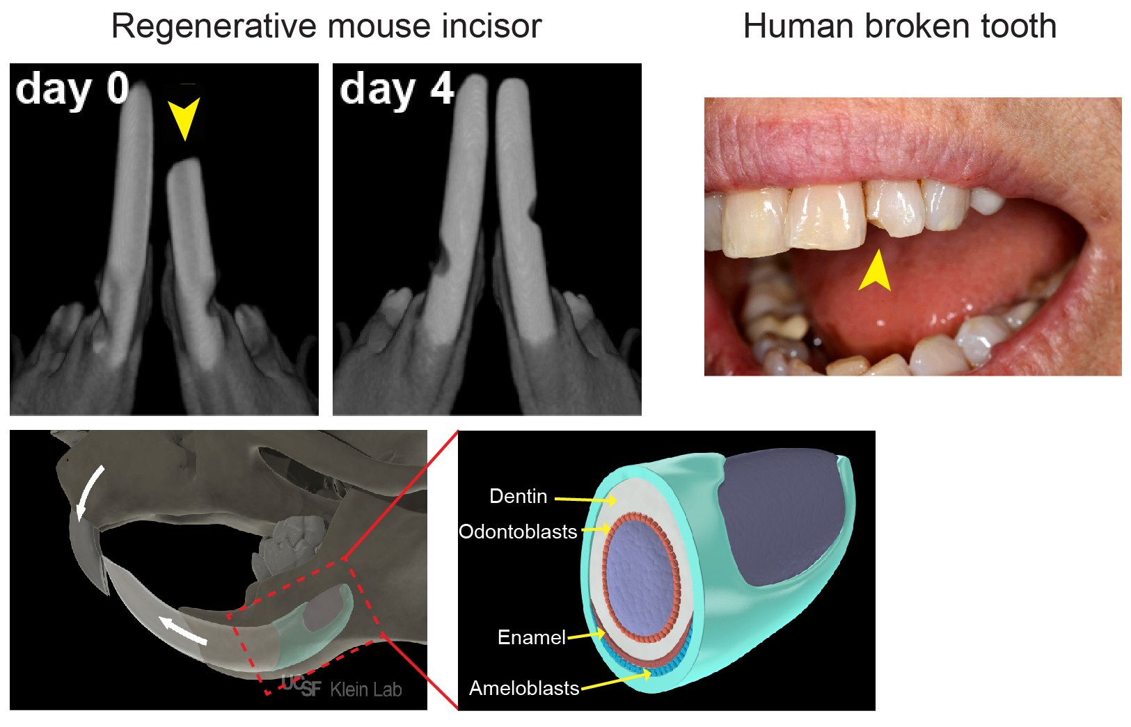 tooth enamel regeneration