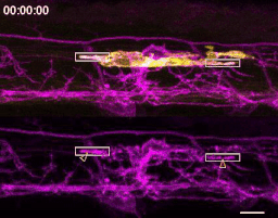 A microglia engulfing nascent myelin sheaths