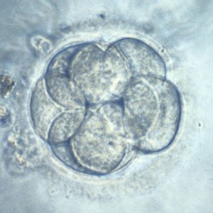 human embryo on a white background