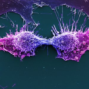 Two purple HeLa cells in the process of dividing