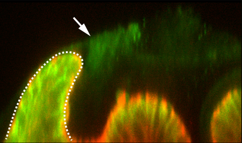 Non-specific staining