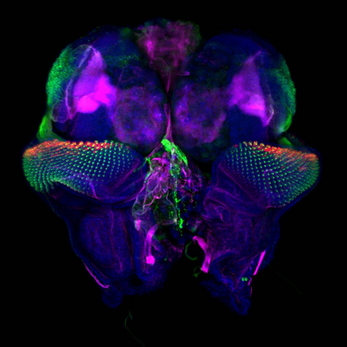 Drosophila eye discs and brain lobes by Tonatiuh Molina Villa