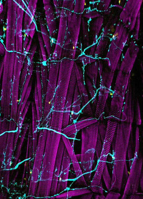 Drosophila larval body wall by Pablo Guzman Palma