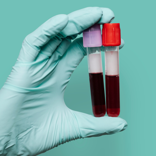 Hand in latex glove holding two vials of blood