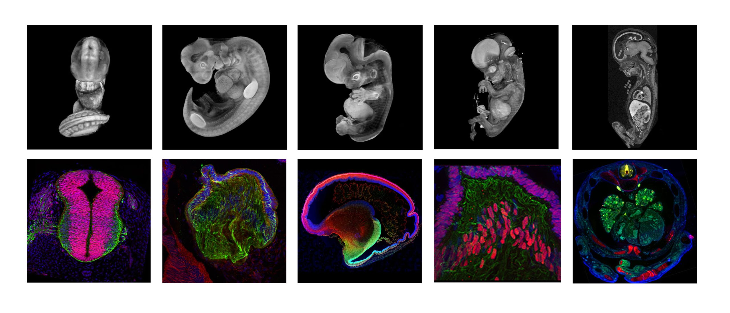 Featured resource: Human Developmental Biology Resource (HDBR