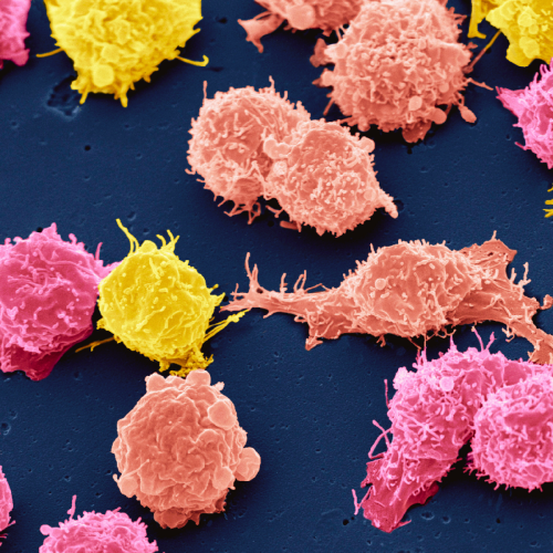 Colourful cancer cells
