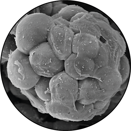 Electron microscope image of Creolimax species, which the Ruiz-Trillo lab works on.