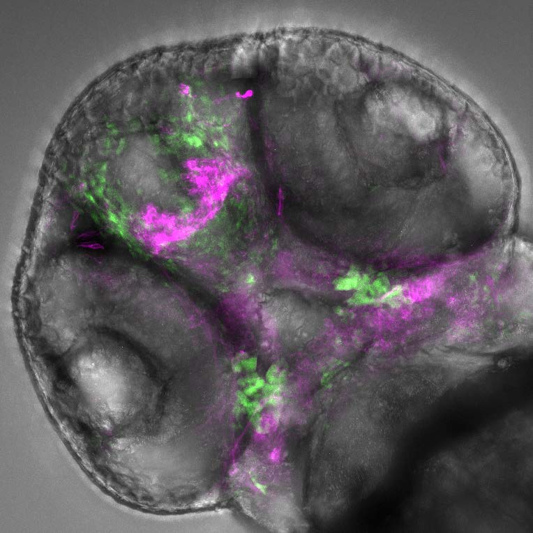 Neanderthal DNA helps explain how faces form