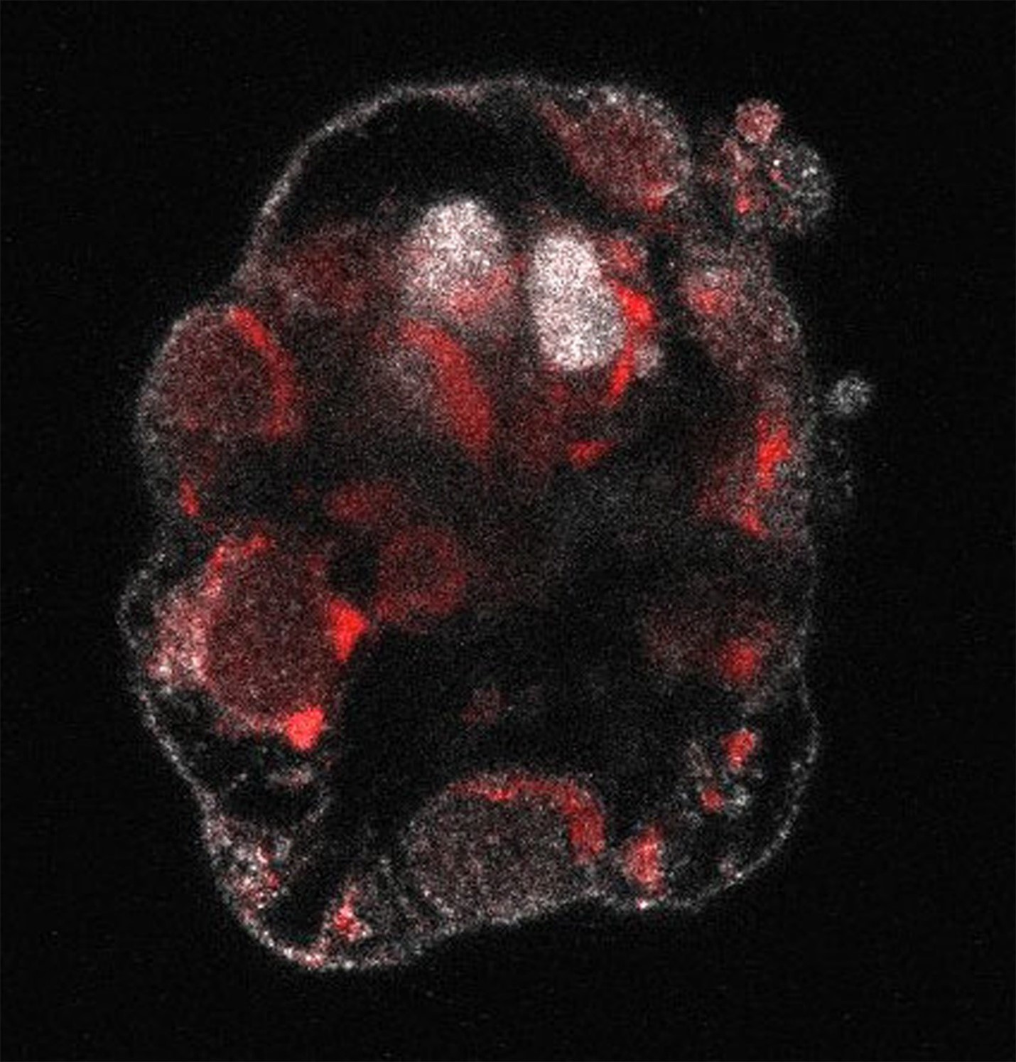 A micrograph shows a clumpy gray collection of epiblast cells — cells that would normally grow into a fetus — that are infected with Zika virus, seen as red splotches in the image. Credit: Watts, J. Ralson, A. Development. 2022